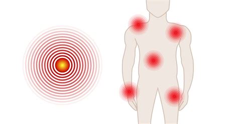 Illustrazione del dolore e della frustrazione dei pazienti