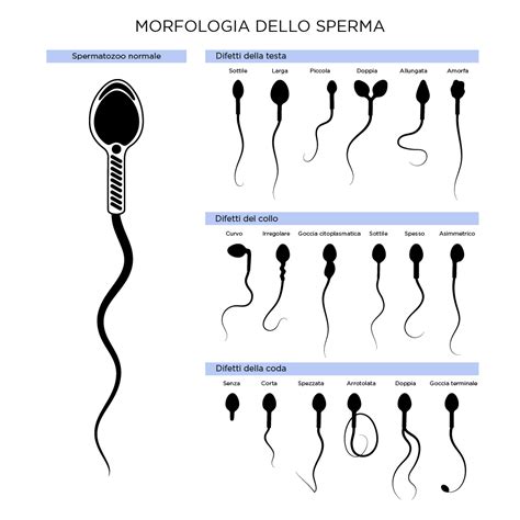 rappresentazione microscopica della qualità e morfologia degli spermatozoi