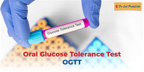 Illustrazione del Test OGTT