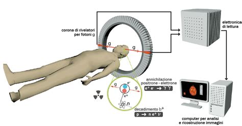 rappresentazione schematica del funzionamento di un tomografo PET