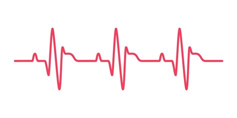Schema del battito cardiaco materno in relazione al ritmo della ninna nanna