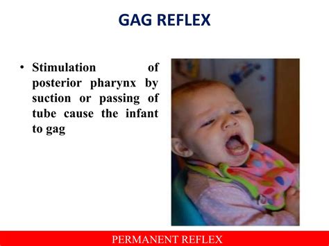 Illustrazione del gag reflex nel bambino