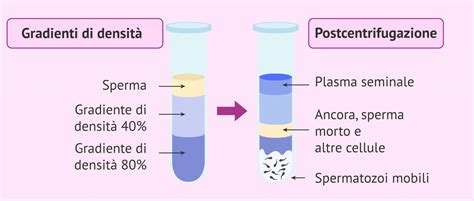 schema comparativo dei metodi di capacitazione swim-up e gradienti di densità