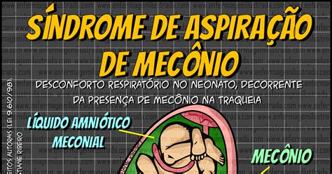 rappresentazione schematica dell'apparato respiratorio neonatale durante l'aspirazione di meconio