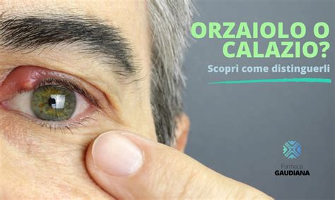 Immagine di orzaiolo sulla palpebra