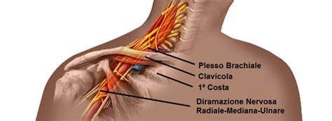 Rappresentazione delle lesioni del plesso brachiale