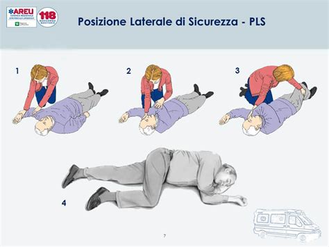 schema che illustra la posizione di sicurezza da far assumere al bambino in caso di crisi convulsiva