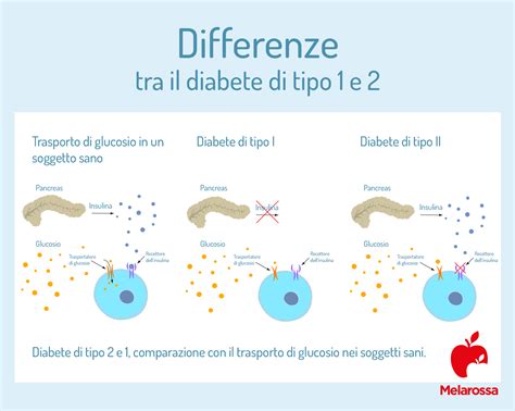 Illustrazione che mostra la differenza tra i tipi di diabete e come il COVID-19 influisce sul corpo.