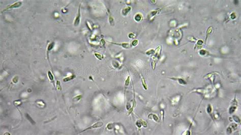 rappresentazione microscopica degli spermatozoi in movimento