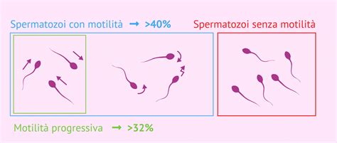 infografica che illustra la concentrazione e motilità degli spermatozoi