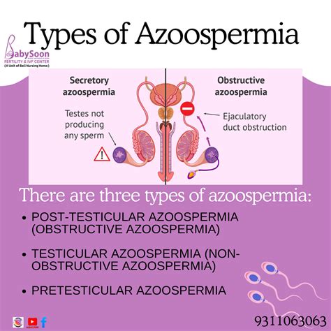 Tipi di azoospermia (ostruttiva vs. secretoria)