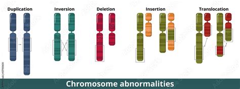 Illustration showing chromosomes and different types of chromosomal anomalies (e.g., trisomy, monosomy)