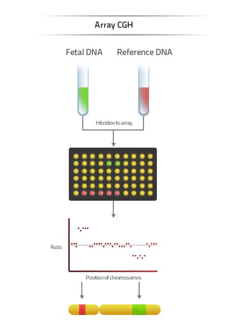 Infographic comparing the timelines of different genetic analysis techniques (QF-PCR, Array CGH, Traditional Karyotyping)