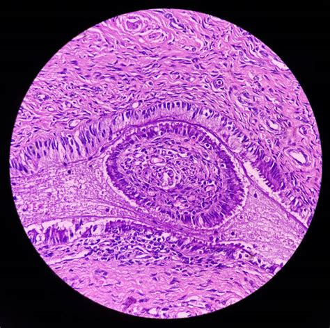 Tessuto endometriale