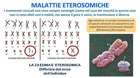 infografica che confronta la sensibilità del NIPT tra diverse anomalie cromosomiche