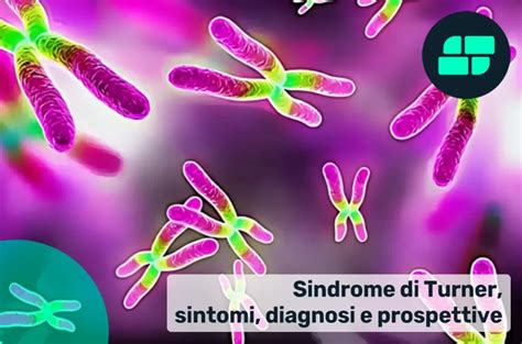 Petto a scudo nella sindrome di Turner