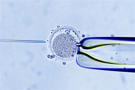 Micrografia del processo ICSI
