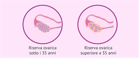 diagramma che illustra il calo della riserva ovarica in relazione all'età femminile