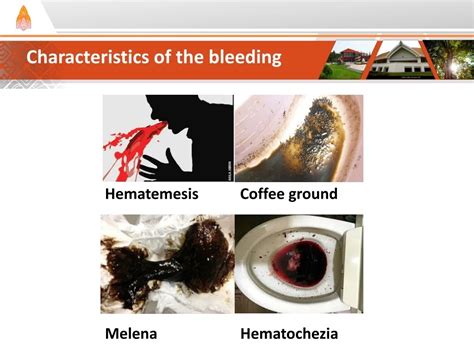 Tipi di sanguinamento rettale (ematochezia vs melena)