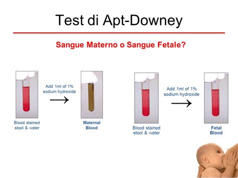 Schema del test di Apt-Downey