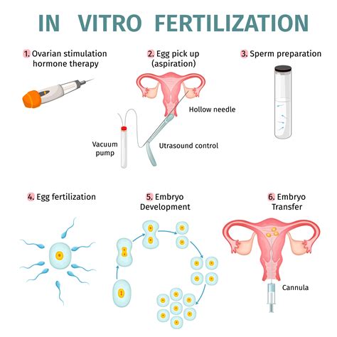 In Vitro Fertilization (IVF) procedure diagram