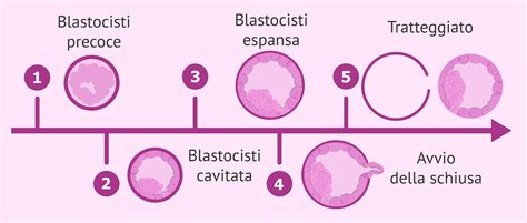 diagramma del processo di biopsia della blastocisti