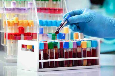 Laboratorio analisi e provette per beta hCG