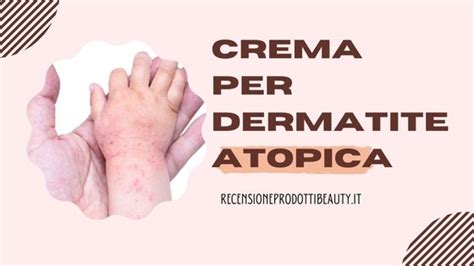 Preparazione di una crema per dermatite