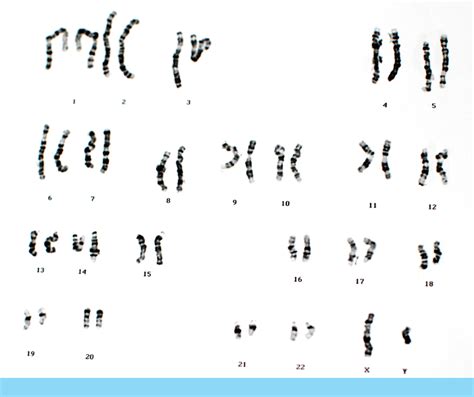 schema dei livelli di analisi cromosomica del test prenatale