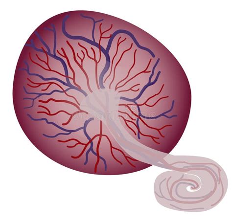 illustrazione anatomica che mostra l'attacco anomalo della placenta alla parete uterina