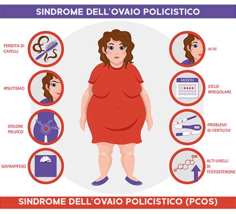 Sindrome dell'Ovaio Policistico e tiroide