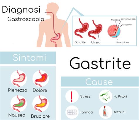 Illustrazione sintomi reflusso e gastrite