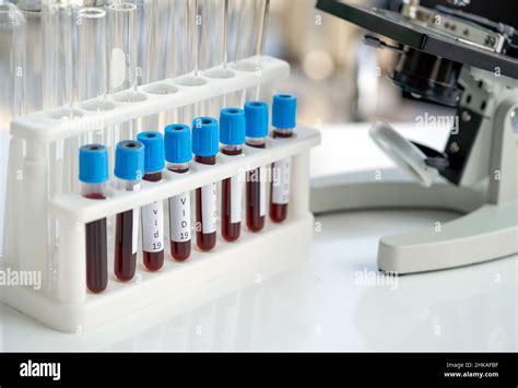 processo di prelievo ematico in laboratorio