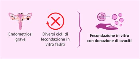 Infografica Dettaglio Costi Ovodonazione IVI (2006-2009)