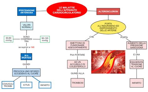 Mappa delle complicazioni delle gravidanze gemellari