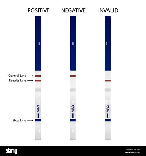 Different types of pregnancy tests (strip, cassette, digital, blood)