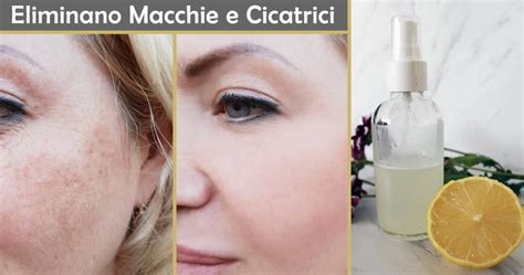 Prodotti naturali per le macchie