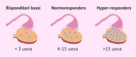 Tipi di Risposta Ovarica alla Stimolazione