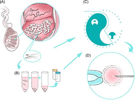 Diagramma del metodo STAR (Sperm Tracking and Recovery)