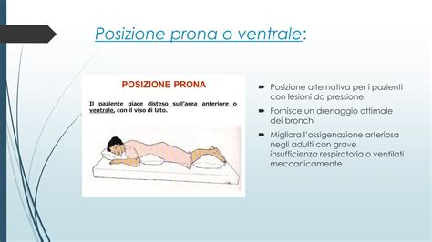 Diagramma che mostra la posizione supina, laterale e prona di un neonato