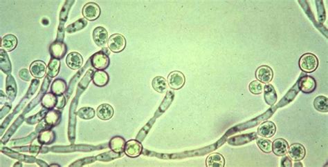 Fungo Candida Albicans al microscopio