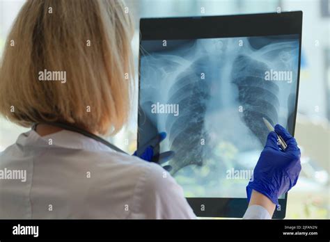 Un medico che esamina una radiografia in una sala operatoria