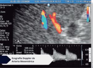 Ecografia Doppler flusso