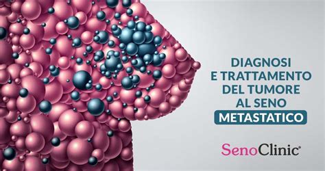 Studi clinici sul tumore al seno e gravidanza