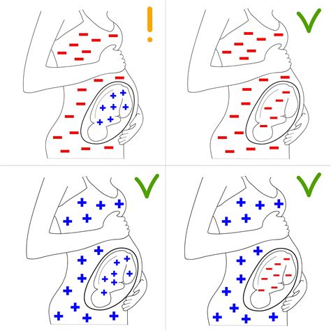 Infografica sul processo di sensibilizzazione materna al fattore Rh durante la gravidanza e il parto