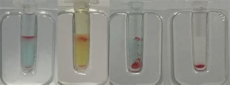 Esecuzione del test di Coombs e analisi di laboratorio per l'incompatibilità sanguigna
