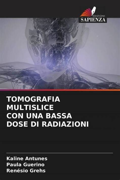 Schema dose radiazioni milligray