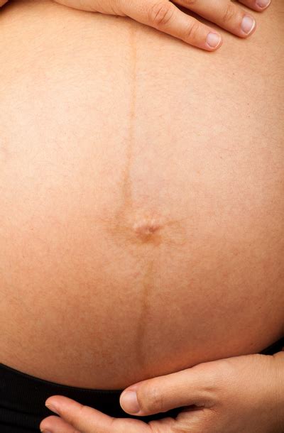 dettaglio anatomico dell'addome femminile con linea nigra