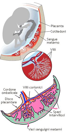 Rappresentazione del distacco di placenta