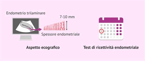 rappresentazione ecografica dell'endometrio trilaminare e sviluppo follicolare